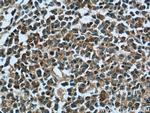 TTC37 Antibody in Immunohistochemistry (Paraffin) (IHC (P))
