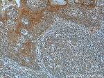 TTC37 Antibody in Immunohistochemistry (Paraffin) (IHC (P))