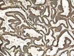 FOXRED1 Antibody in Immunohistochemistry (Paraffin) (IHC (P))