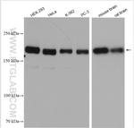 Tuberin Antibody in Western Blot (WB)