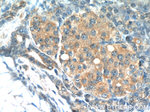 Tuberin Antibody in Immunohistochemistry (Paraffin) (IHC (P))