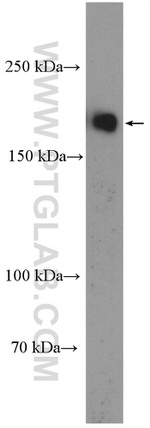 Tuberin Antibody in Western Blot (WB)