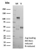 Glucagon (Marker of Glucagonoma) Antibody in SDS-PAGE (SDS-PAGE)