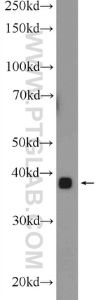 MBNL3 Antibody in Western Blot (WB)