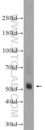 TMPRSS5 Antibody in Western Blot (WB)