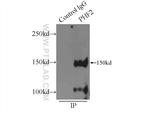 PHF2 Antibody in Immunoprecipitation (IP)