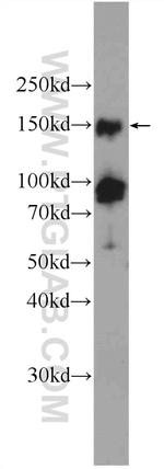 PHF2 Antibody in Western Blot (WB)