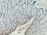 CEACAM7 Antibody in Immunohistochemistry (Paraffin) (IHC (P))