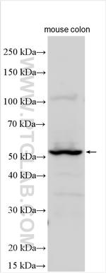 CEACAM7 Antibody in Western Blot (WB)