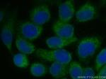 TMEM111 Antibody in Immunocytochemistry (ICC/IF)