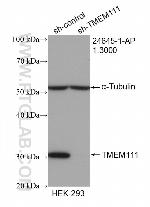 TMEM111 Antibody in Western Blot (WB)