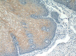 SPRR2F Antibody in Immunohistochemistry (Paraffin) (IHC (P))