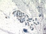 SPRR2F Antibody in Immunohistochemistry (Paraffin) (IHC (P))