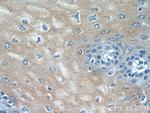 SPRR2F Antibody in Immunohistochemistry (Paraffin) (IHC (P))