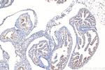 SPRR2F Antibody in Immunohistochemistry (Paraffin) (IHC (P))