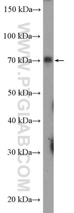 SGLT2 Antibody in Western Blot (WB)