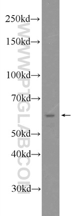 EHD1 Antibody in Western Blot (WB)