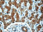 PHKA2 Antibody in Immunohistochemistry (Paraffin) (IHC (P))