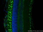 OPN1SW Antibody in Immunohistochemistry (PFA fixed) (IHC (PFA))