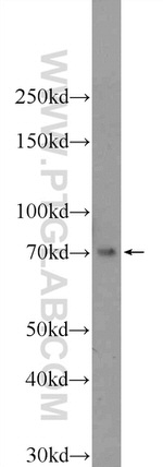 RBPJL Antibody in Western Blot (WB)