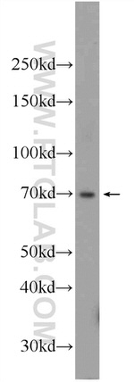 RBPJL Antibody in Western Blot (WB)