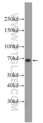RBPJL Antibody in Western Blot (WB)