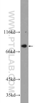 ZBTB48 Antibody in Western Blot (WB)