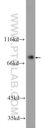 ZBTB48 Antibody in Western Blot (WB)
