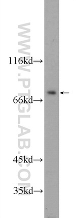 ZBTB48 Antibody in Western Blot (WB)