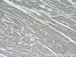 TBC1D4 Antibody in Immunohistochemistry (Paraffin) (IHC (P))