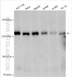 TBC1D4 Antibody in Western Blot (WB)
