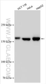 TBC1D4 Antibody in Western Blot (WB)