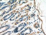 B4GALNT3 Antibody in Immunohistochemistry (Paraffin) (IHC (P))