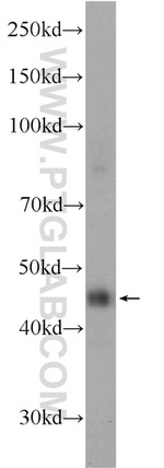 C20orf46 Antibody in Western Blot (WB)
