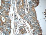 C20orf46 Antibody in Immunohistochemistry (Paraffin) (IHC (P))