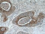 SPRR1A Antibody in Immunohistochemistry (Paraffin) (IHC (P))