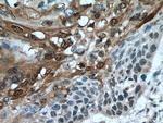 SPRR1A Antibody in Immunohistochemistry (Paraffin) (IHC (P))