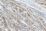 SPRR1A Antibody in Immunohistochemistry (Paraffin) (IHC (P))