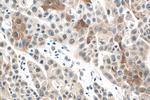 SPRR1A Antibody in Immunohistochemistry (Paraffin) (IHC (P))