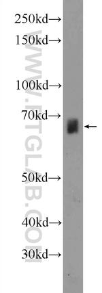ZNF284 Antibody in Western Blot (WB)