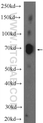 ZNF284 Antibody in Western Blot (WB)