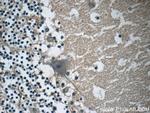 AMMECR1 Antibody in Immunohistochemistry (Paraffin) (IHC (P))