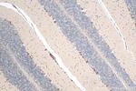 AMMECR1 Antibody in Immunohistochemistry (Paraffin) (IHC (P))