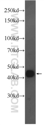 AMMECR1 Antibody in Western Blot (WB)