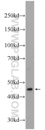 AMMECR1 Antibody in Western Blot (WB)