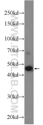 AMMECR1 Antibody in Western Blot (WB)