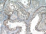 CCDC99 Antibody in Immunohistochemistry (Paraffin) (IHC (P))