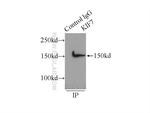 KIF7 Antibody in Immunoprecipitation (IP)