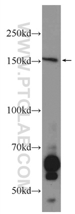 KIF7 Antibody in Western Blot (WB)