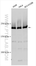KNTC1 Antibody in Western Blot (WB)